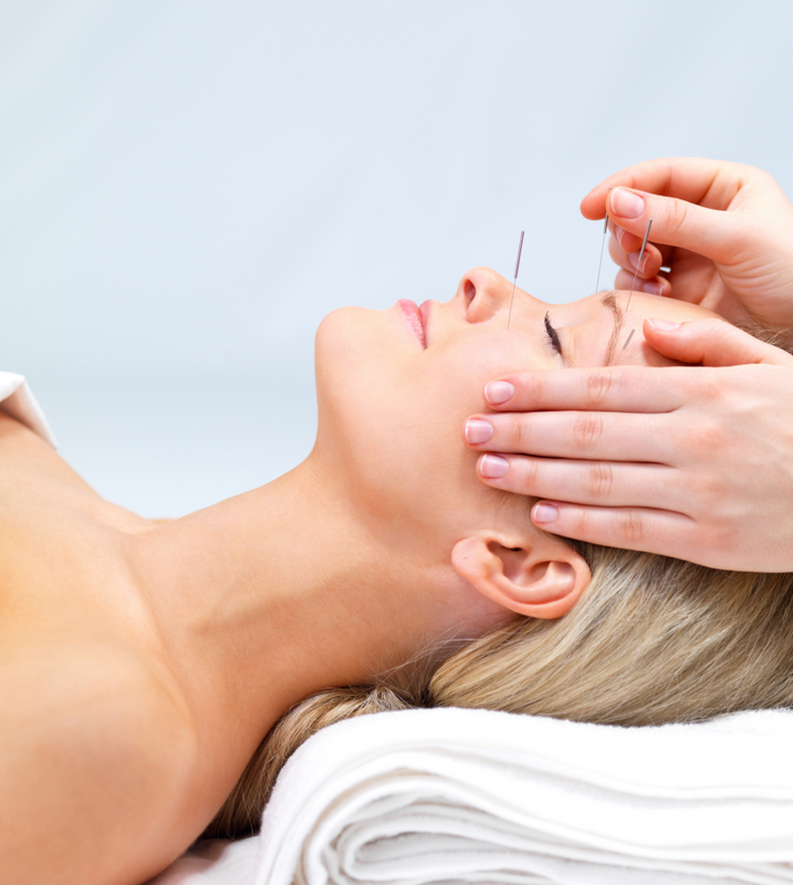 FAQ’s Cosmetic Acupuncture