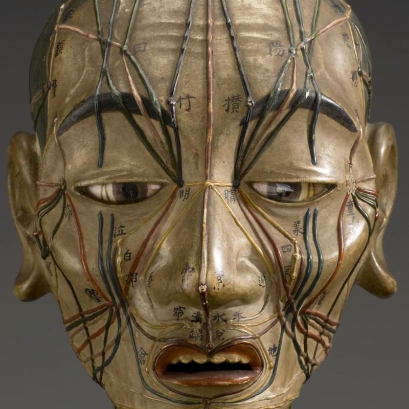 Trigeminal Neuralgia